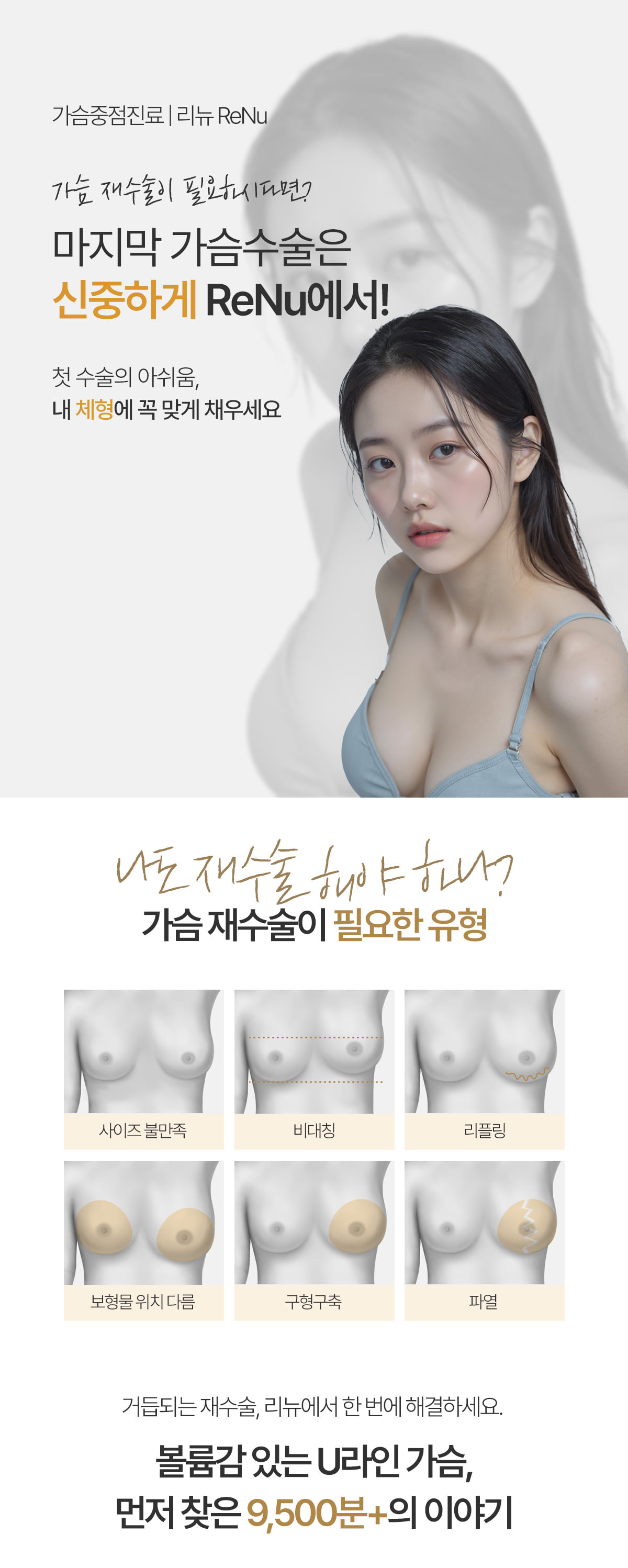 가슴 재수술 이미지 1