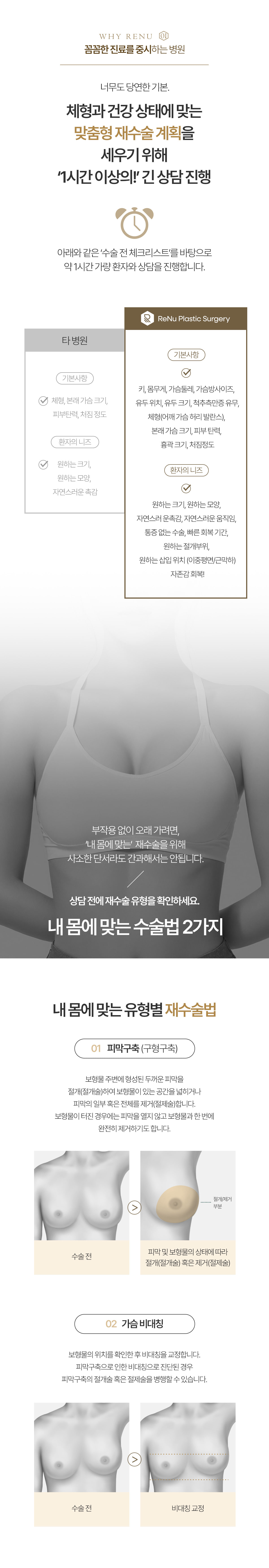 가슴 재수술 이미지 11